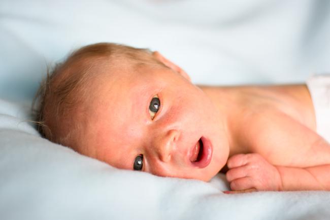 Mata Bayi Kuning Apakah Normal? Ini 8 Penyebabnya