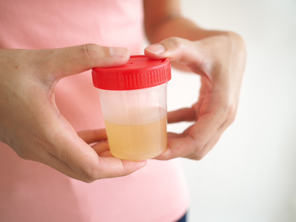Kini Deteksi Dini Kanker Serviks Bisa Pakai Sampel Urine, Ini Penjelasannya!