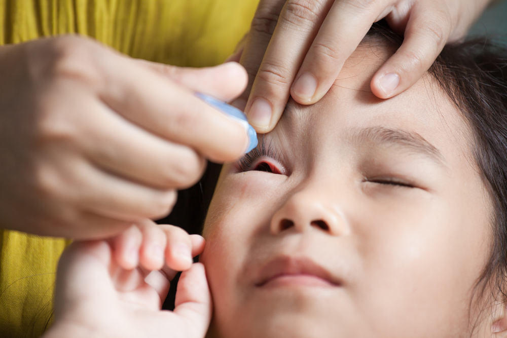 10 Rekomendasi Obat Tetes untuk Mengobati Mata Merah pada Anak