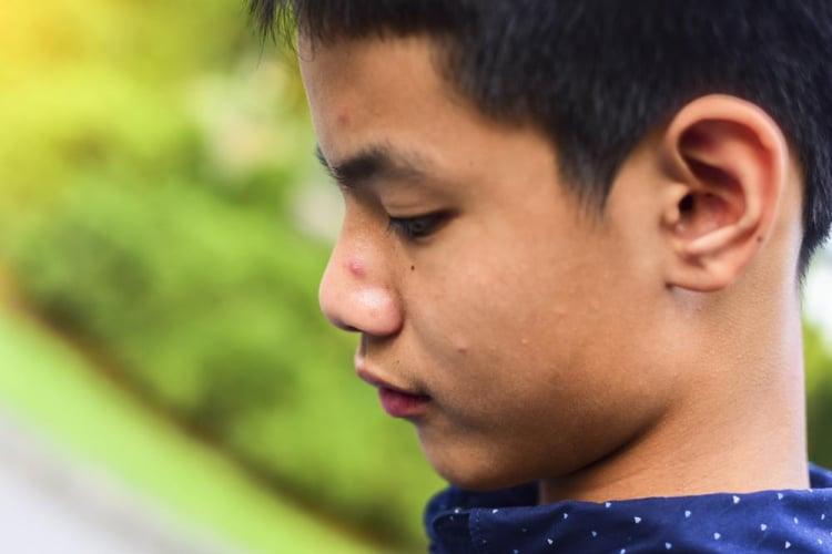 Pubertas Terlambat: Ciri-Ciri, Penyebab, dan Cara Mengatasi