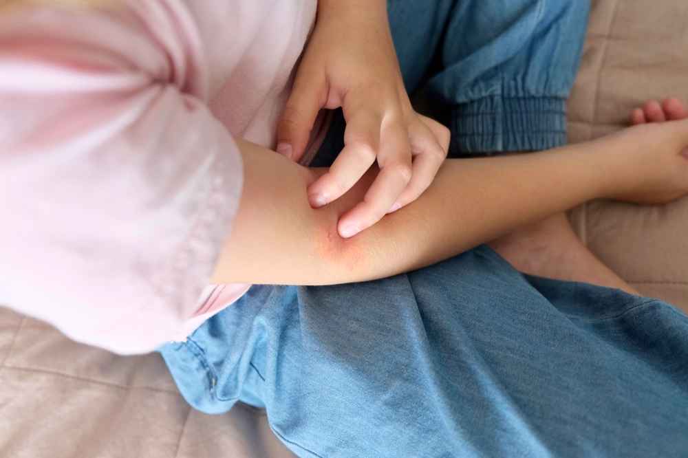 5 Jenis Penyakit Autoimun pada Anak serta Ciri dan Pengobatannya