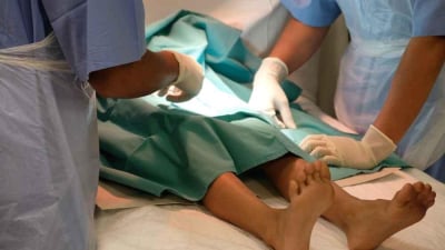 biaya sunat di klinik