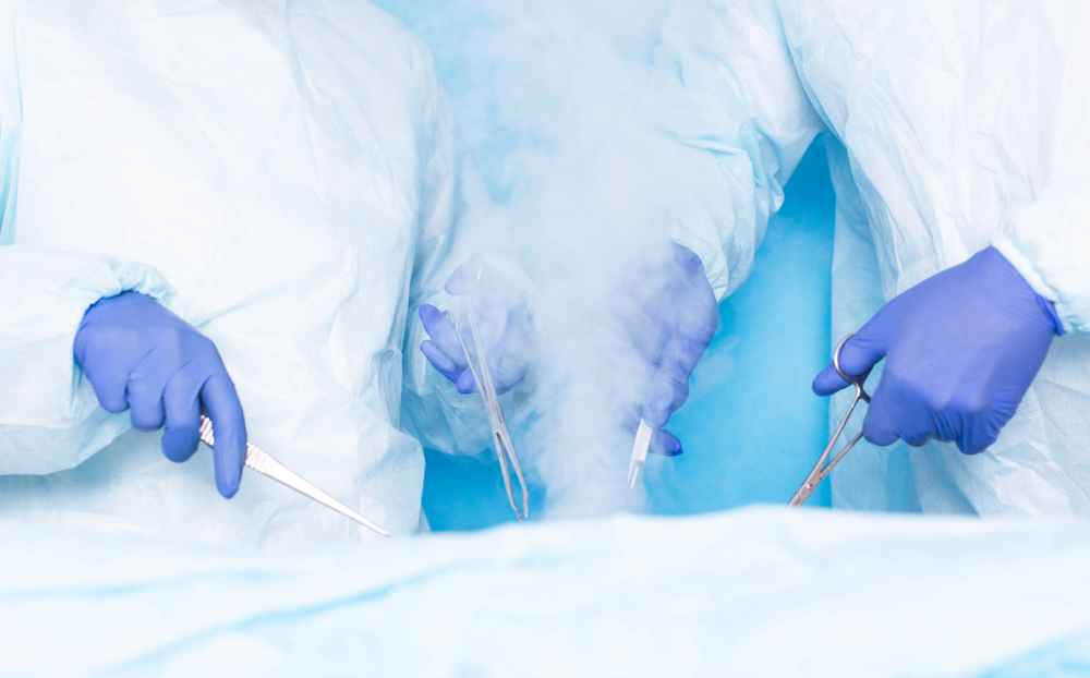 Cryosurgery