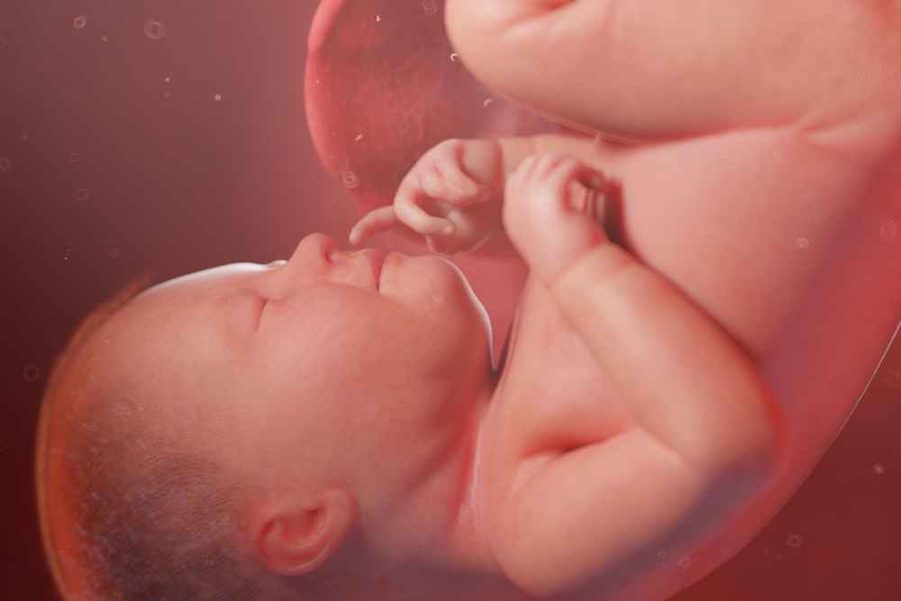 Fetus In Fetu, Saat Janin Jadi Parasit bagi Tubuh Kembarannya