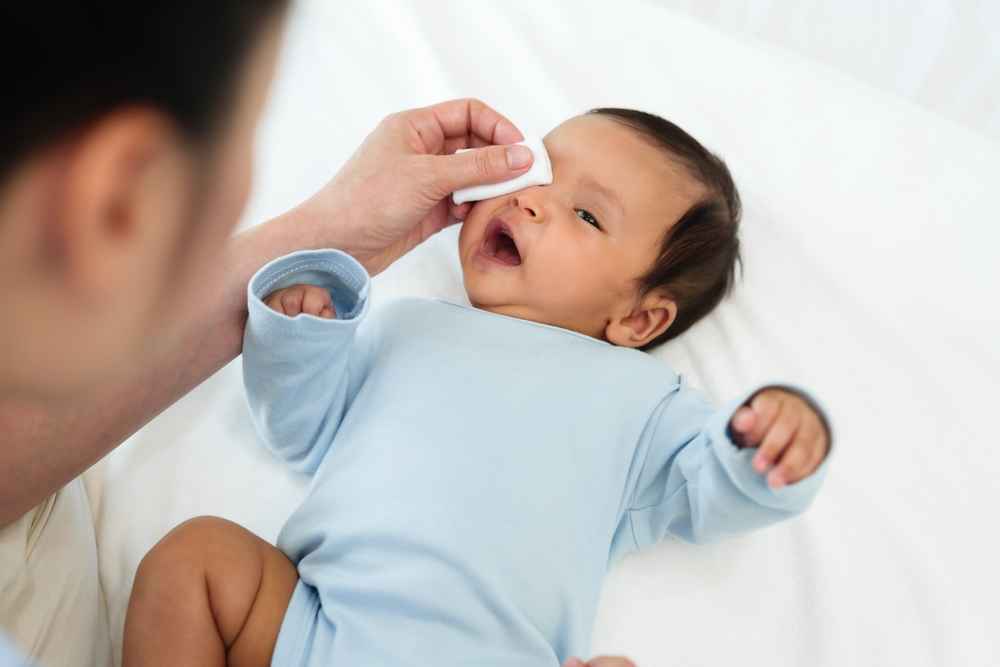 4 Penyebab Mata Bayi Berair serta Cara Tepat Mengobatinya