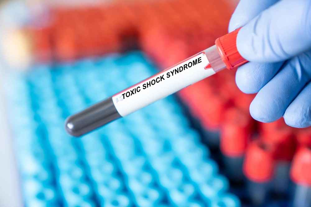 toxic shock syndrome