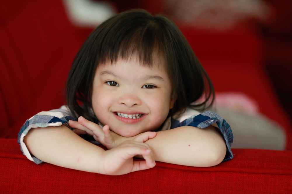 Kenapa Anak Down Syndrome Punya Wajah yang Khas?