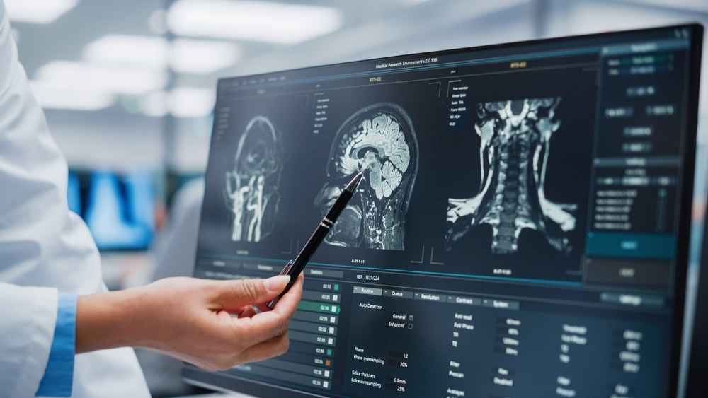 Digital Subtraction Angiography: Definisi, Prosedur, dll.