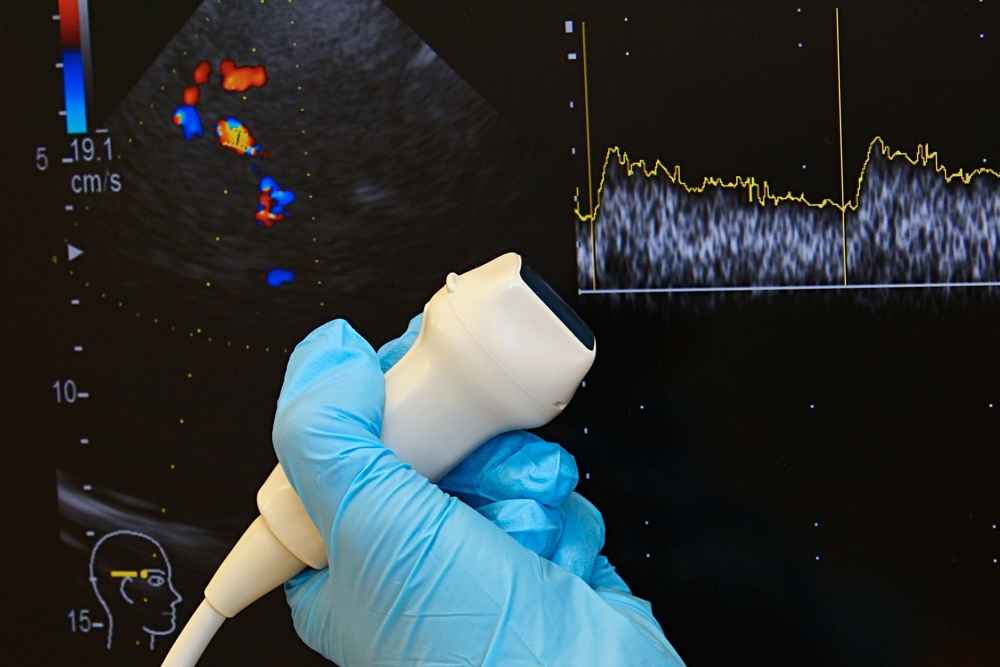 transcranial-doppler