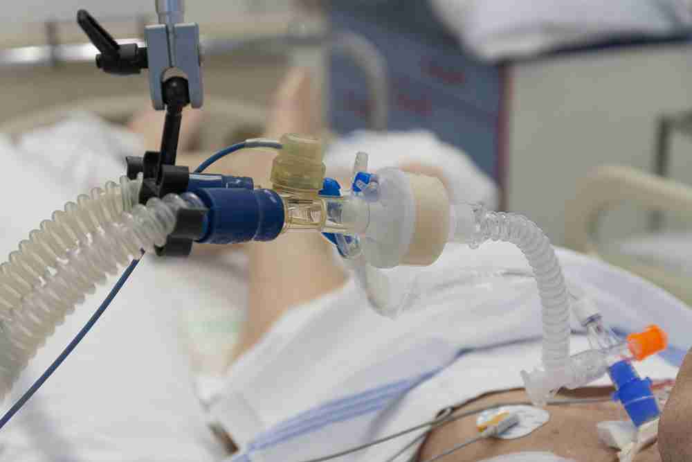 vap-ventilator-associated-pneumonia