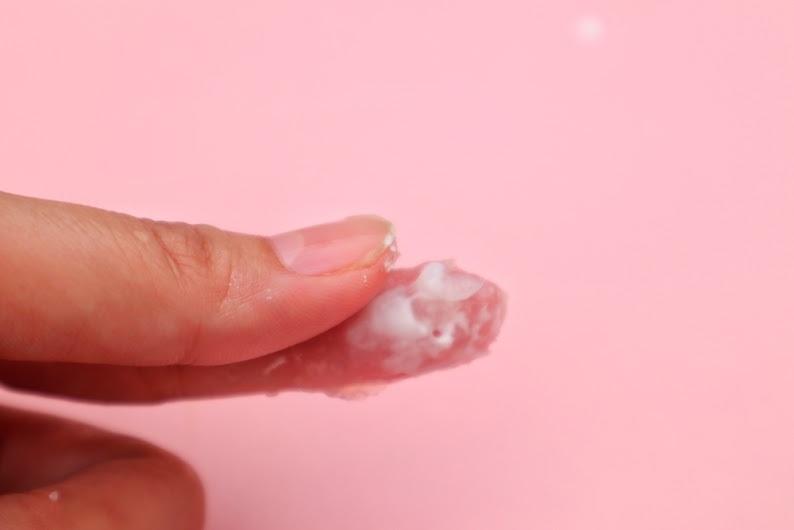 Keputihan Seperti Ampas Tahu Saat Hamil, Apakah Normal?