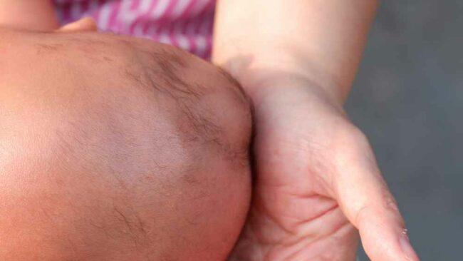 16 Penyebab Benjolan di Kepala Bayi dan Cara Mengatasinya