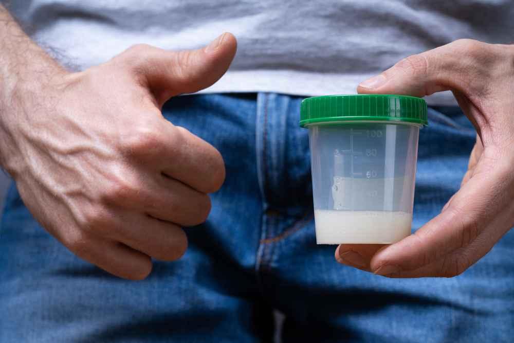 7 Cara Mengeluarkan Sperma untuk Tes Kesuburan