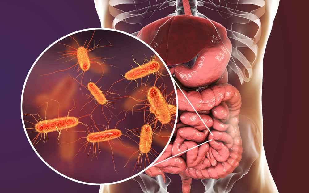 dysbiosis