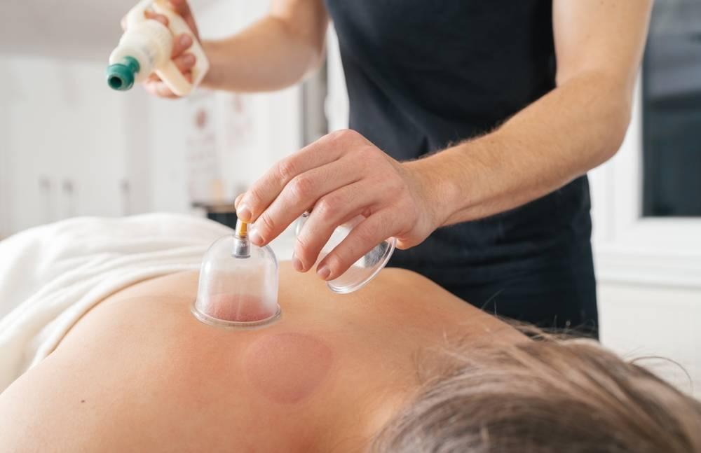 4 Manfaat Titik Bekam Jantung dan Efek Sampingnya