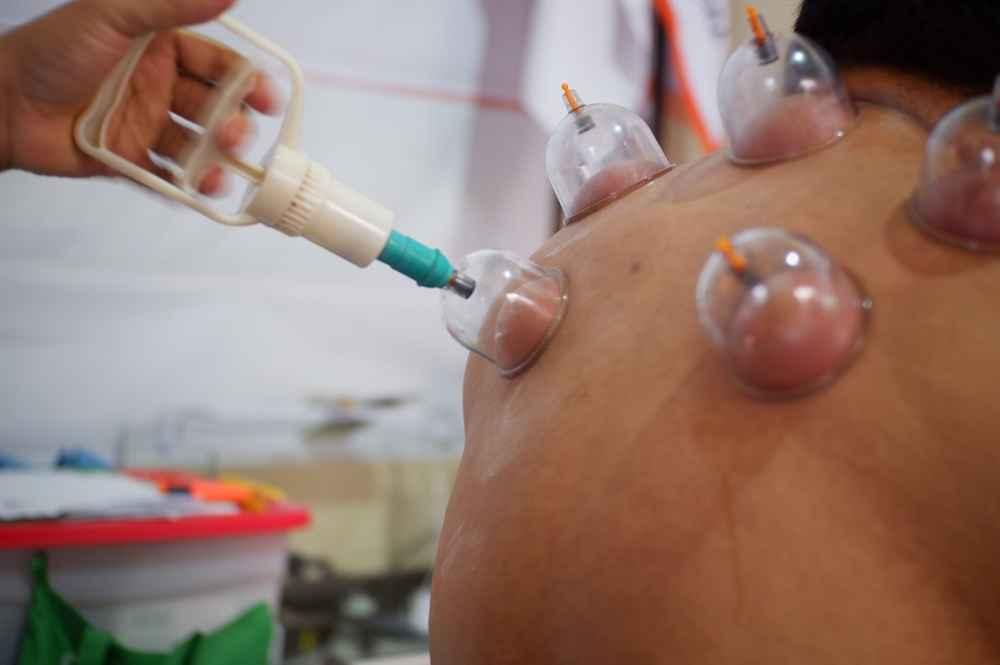 5 Ciri Darah Bekam Kolesterol yang Dapat Anda Lihat