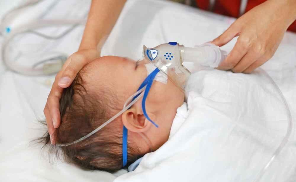 pneumonia-neonatal