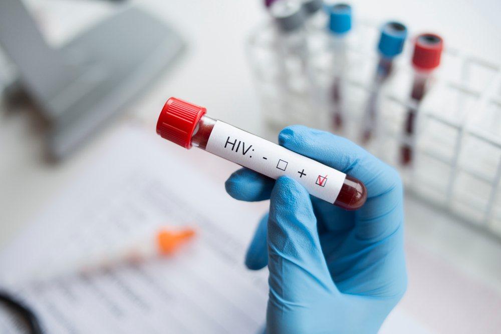 perbedaan-sifilis-dan-hiv