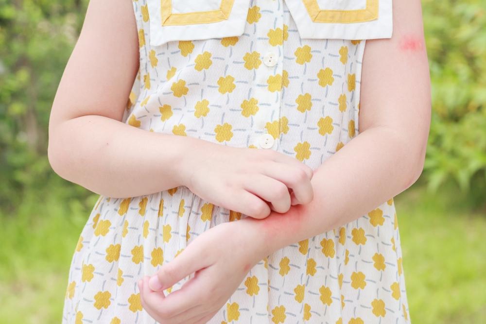 Orangtua Punya Riwayat Alergi? Ini Cara Cek Risiko Alergi si Kecil Sejak Dini