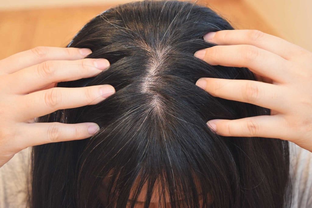 Yuk, Atasi Rambut Lepek Berminyak dengan 5 Cara Ini!