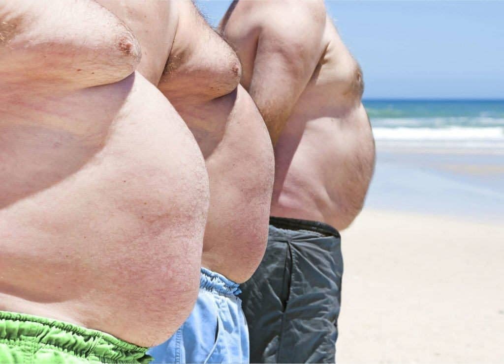 Benarkah Obesitas Dapat Menyebabkan Serangan Jantung?