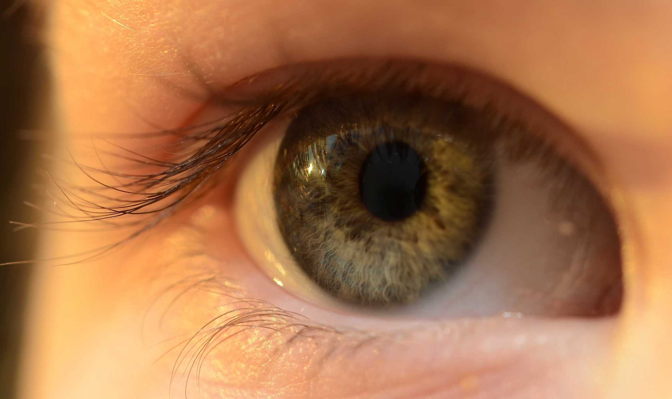 8 Kesalahan Pakai Lensa Kontak yang Berisiko Bahaya bagi Mata